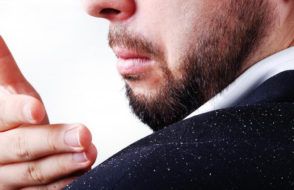 Best natural Home Remedies for Dandruff Treatment