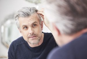 How to Stop losing Hair and Natural Cure for Baldness?