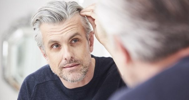 How To Stop Thinning Hair In Men Naturally