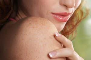 List of Common Skin Diseases and their Symptoms