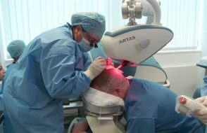 4 Reasons you Should Opt FUT Hair Transplant Technique