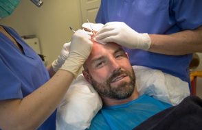 Cosmetic Procedures makes Hair Transplantation natural looking