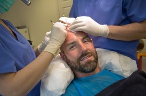 Cosmetic Procedures makes Hair Transplantation natural looking
