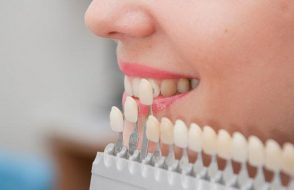 7 benefits of Cosmetic Dentistry using Porcelain Veneers