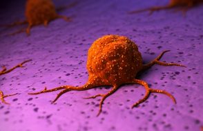 4 different Types of Cancer associated with Body Functions