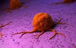 4 different Types of Cancer associated with Body Functions