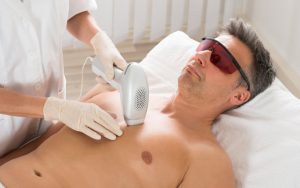 Explore more about professional Laser Hair removal machines