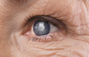 Types of Glaucoma and How to treated with them?