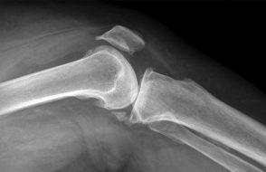 What are the various Orthopedic Surgeons Treats?