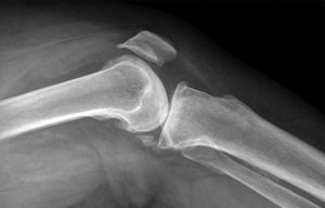 What are the various Orthopedic Surgeons Treats?