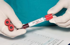 When to Test for HIV? Importance of Early HIV Diagnosis