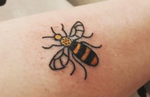 Factors to Consider for a Successful Tattoo Removal with Laser Treatments