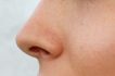 5 Things to know before your Septoplasty Surgery