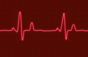 What are the Tricks to recover from Cardiovascular illness?