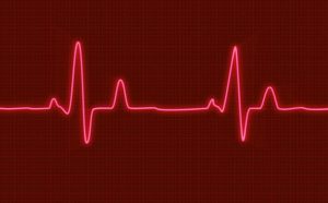 What are the Tricks to recover from Cardiovascular illness?