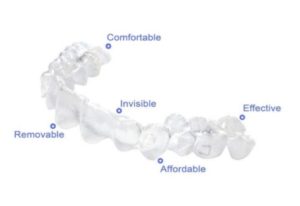 The Advantages and Disadvantages of Invisalign and Braces