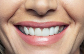 5 Tips when Selecting the best Dentist for Oral Health