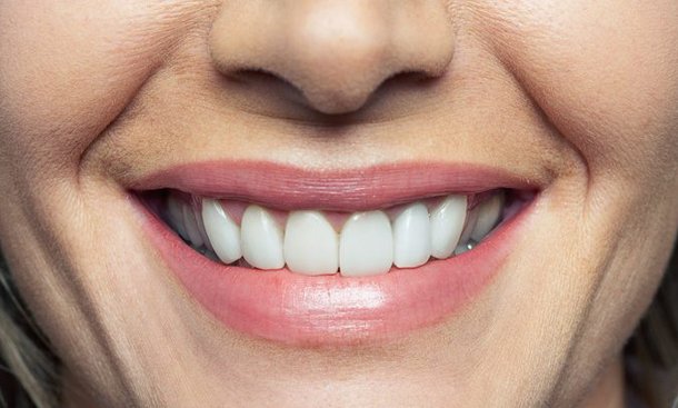 5 Tips when Selecting the best Dentist for Oral Health