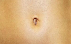 What is a Gastric Balloon and How does it Work?