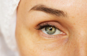 Blepharoplasty - What is it, and What are the Benefits?