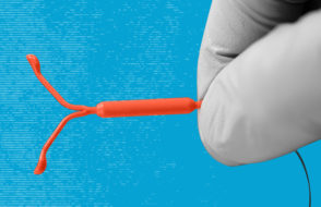 What you Can expect after Fitting a Contraceptive Coil?