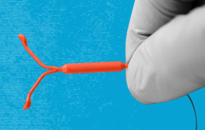 What you Can expect after Fitting a Contraceptive Coil?