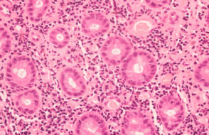 Assurepathlabs - The best Pathology Labs in Jalandhar, Punjab