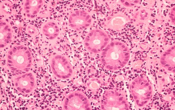 Assurepathlabs - The best Pathology Labs in Jalandhar, Punjab