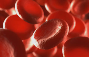 Cause of Aplastic Anemia like Drugs, Chemotherapy or Radiation therapies