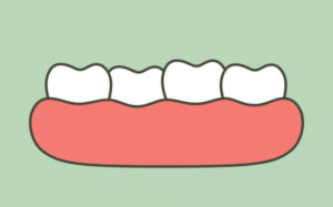 Benefits of Getting Scaling and Polishing for Teeth