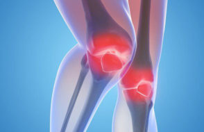 What are the Natural Therapies for Arthritis Pain?