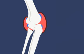 Resume your Normal Life with the Help of Occupational Therapy