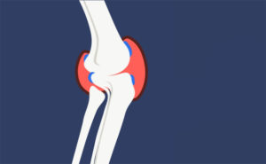 Resume your Normal Life with the Help of Occupational Therapy