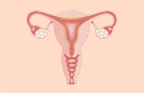 Painful Periods, Pregnancy or bleeding 7 Signs to go for a Gynecologist