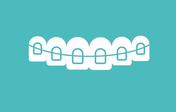 Do Clear Aligners Work for Teeth Straightening?