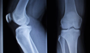 4 Ways to Save on Medical Imaging Services