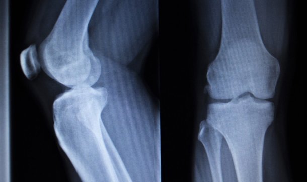 4 Ways to Save on Medical Imaging Services