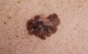 A Deep Dive into the Roundup Cancer Cases and Settlements