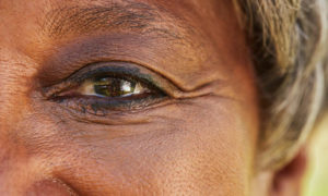 Cataract Surgery - How to Find best Eye Hospitals?