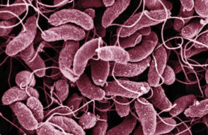 What Is Cholera? Symptoms, Causes, Diagnosis