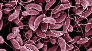 What Is Cholera? Symptoms, Causes, Diagnosis