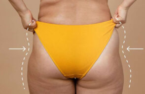 Information need to know before Hip Arthroplasty