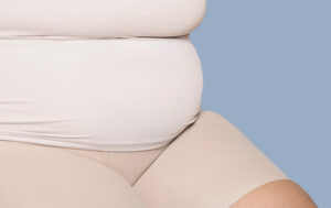 How to Prepare for a Tummy Tuck in Islamabad?