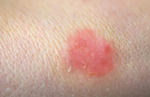 Beyond the Mirror: The Rise of Preventive Skincare in Modern Wellness