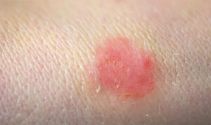 Beyond the Mirror: The Rise of Preventive Skincare in Modern Wellness