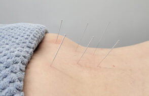 Can Acupuncture in San Diego Help you Feel balanced again?